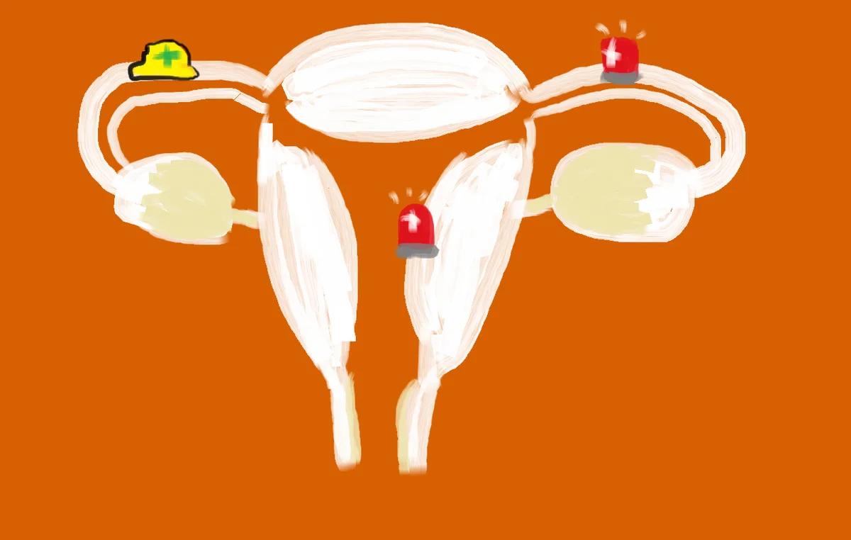 Uterus illustration